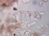 Diatom, Aulacoseira (Melosira)